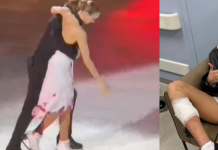 Video| Patinador sobre hielo le cortó la pierna a su compañera y su reacción dejó sorprendidos a todos
